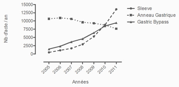 Répartition des différents actes en chirurgie de l'obésité